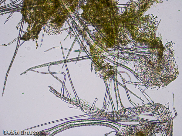 Specimen: Phacelia californica leaf hairs  /  Microscope: Leica DM500 