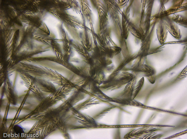 Specimen: Tarantula Type I urticating hairs, DV  /  Microscope: Leica DM500 