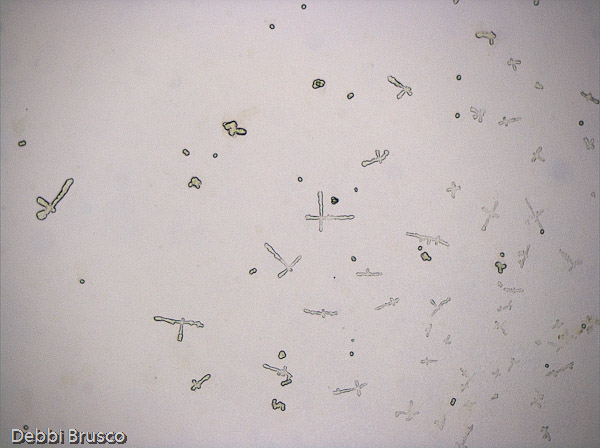 Specimen: Unknown precipitate from Bay nut  /  Microscope: Leica DM500 