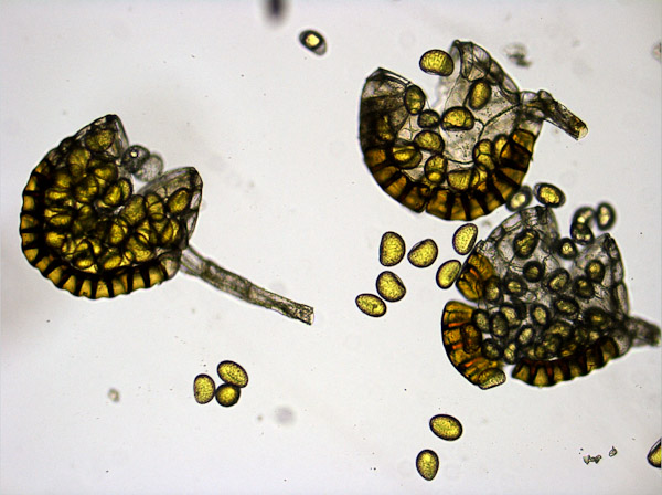 Specimen: California Polypody (Polypodium californicum) sporangia and spores, mature  /  Microscope: Leica DM500 