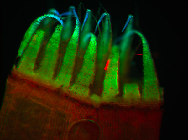 Specimen: Moss, capsule, RRP 2/28/11  /  Microscope: Leica DM500 