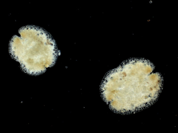Specimen: Lunularia gemmae, RRP 2/28/11  /  Microscope: ZeissAxioimagerA1 