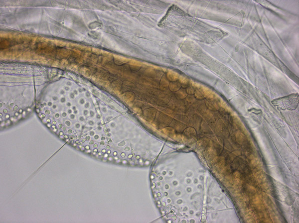 Specimen: Phantom midge larva body (Chaoborus sp), Coal Mine Ridge 4/11/11  /  Microscope: ZeissAxioimagerA1 