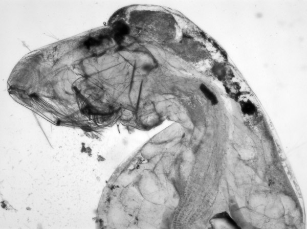 Specimen: Phantom midge larva head Chaoborus sp), Coal Mine Ridge 4/11/11  /  Microscope: Nikon Eclipse 80i 
