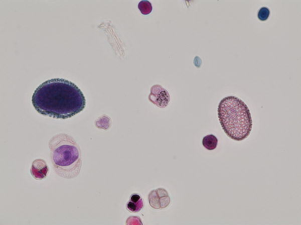 Specimen: Mixed Pollen Grains wm, Carolina 30-4264 D120-7  /  Microscope: Nikon Eclipse 80i 