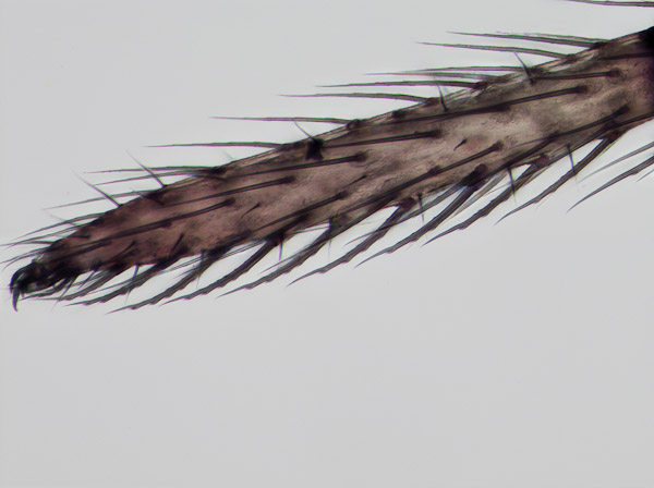 Specimen: 10/27 Theradiidae, cobweb, fence corner, fourth tarsal comb  /  Microscope: Nikon Eclipse 80i  