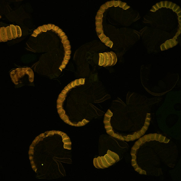 Specimen: Lady Fern sporangia, max projection  /  Microscope: Leica SP5  