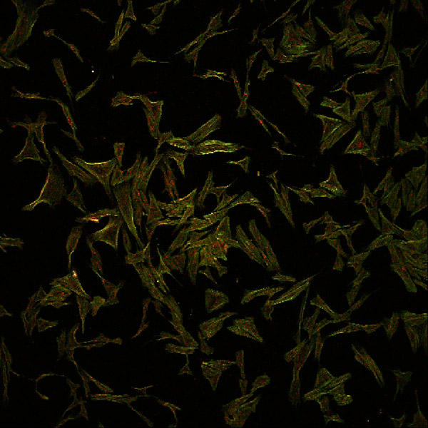 Specimen: Invitrogen Fluocells #6, Muntjac cells  /  Microscope: Leica SP5  