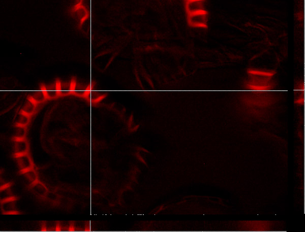 Specimen: Lady Fern sporangia, glycerin imm, orthogonal view  /  Microscope: Leica AF6000LX  